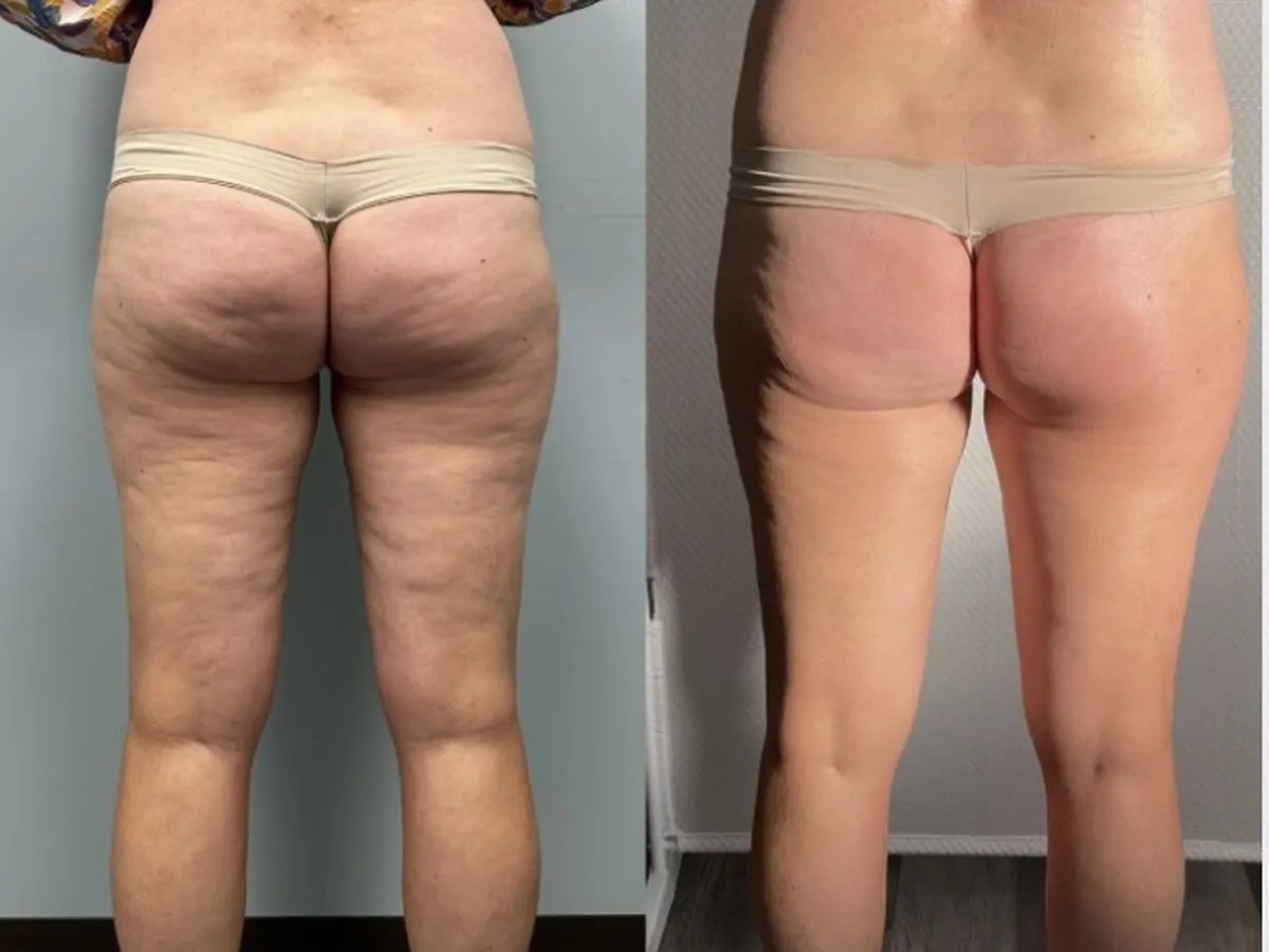 Before and after, treatment results, image 5 of 6
