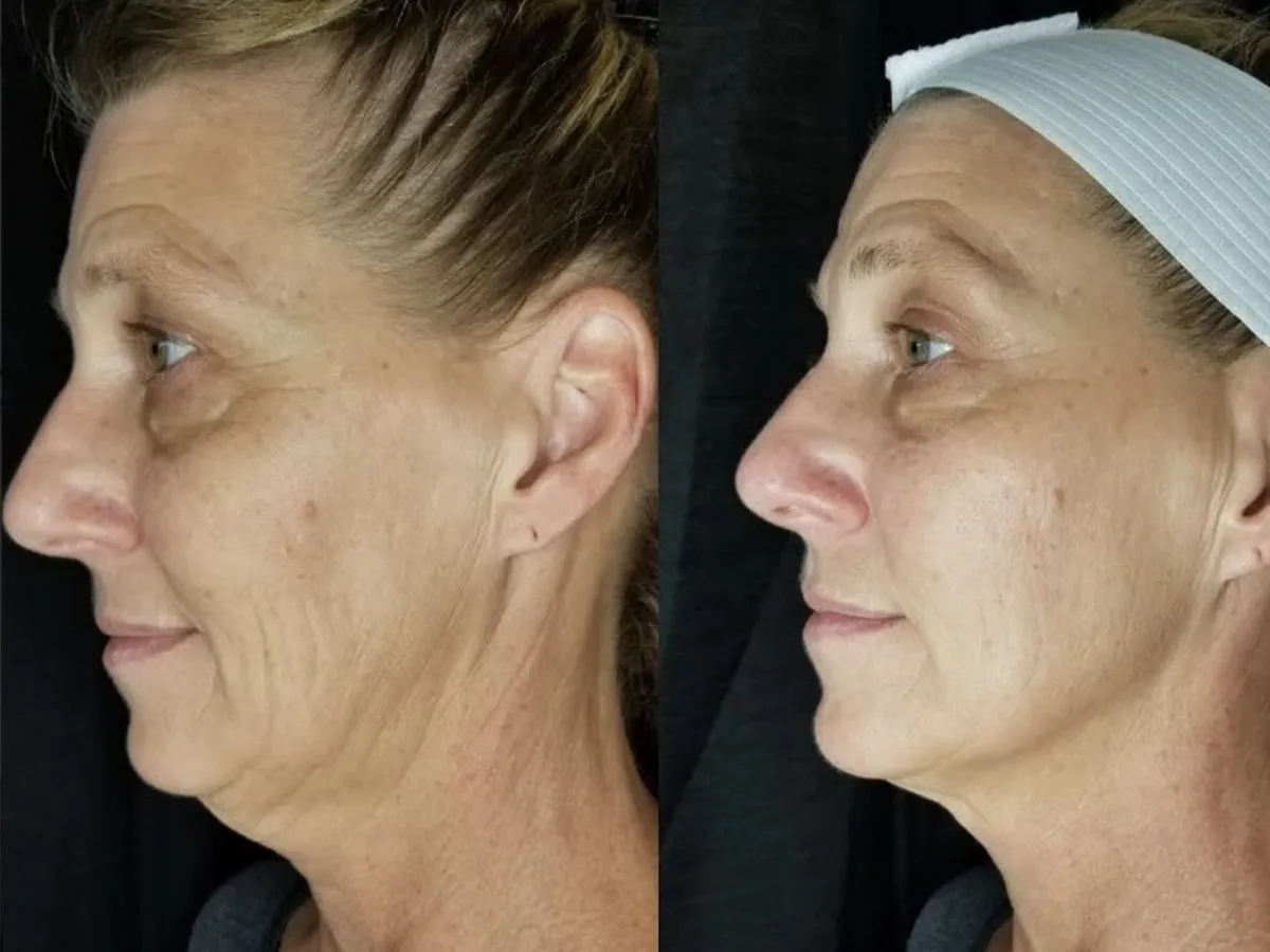 Before and after, treatment results, image 4 of 6